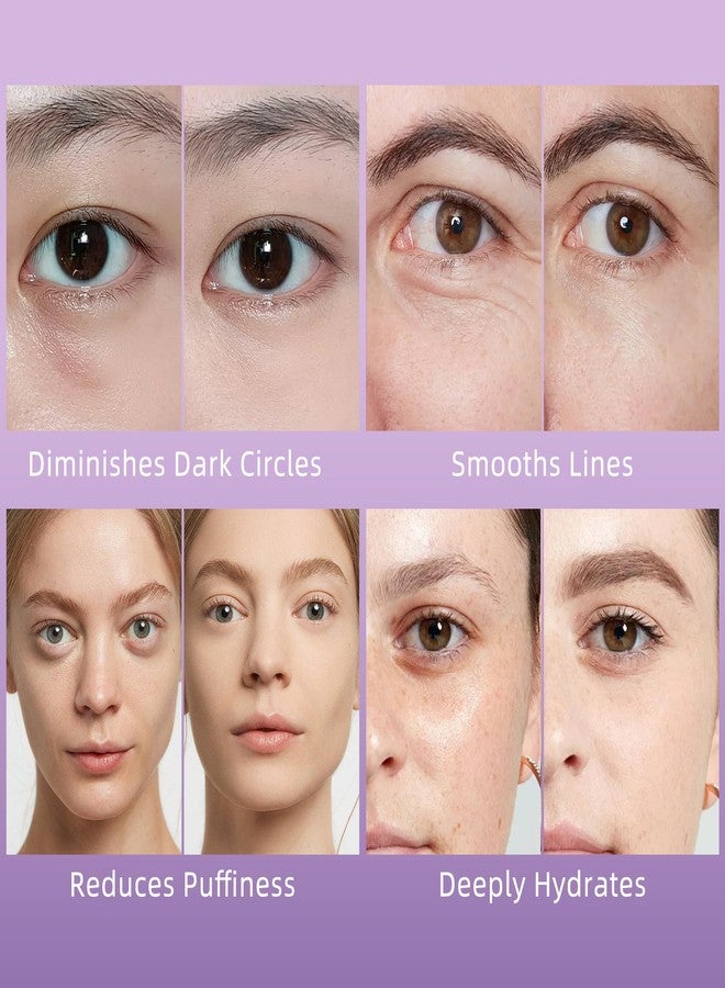 YAFUSIPE Caffeine Eye Serum for Puffy Dark Circles, Instant Depuffing Under Eye Treatment Anti-Aging Firming Undereye Serum with Roller for Wrinkles Bags Fine Lines Brightening Christmas 0.5 Floz - Image 2